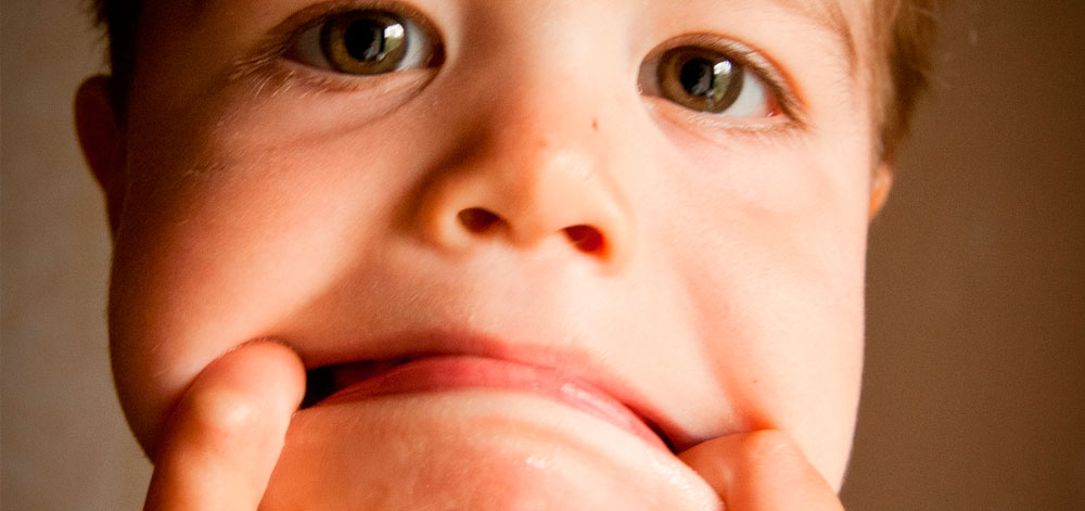 Pulpotomía, la endodoncia de los niños