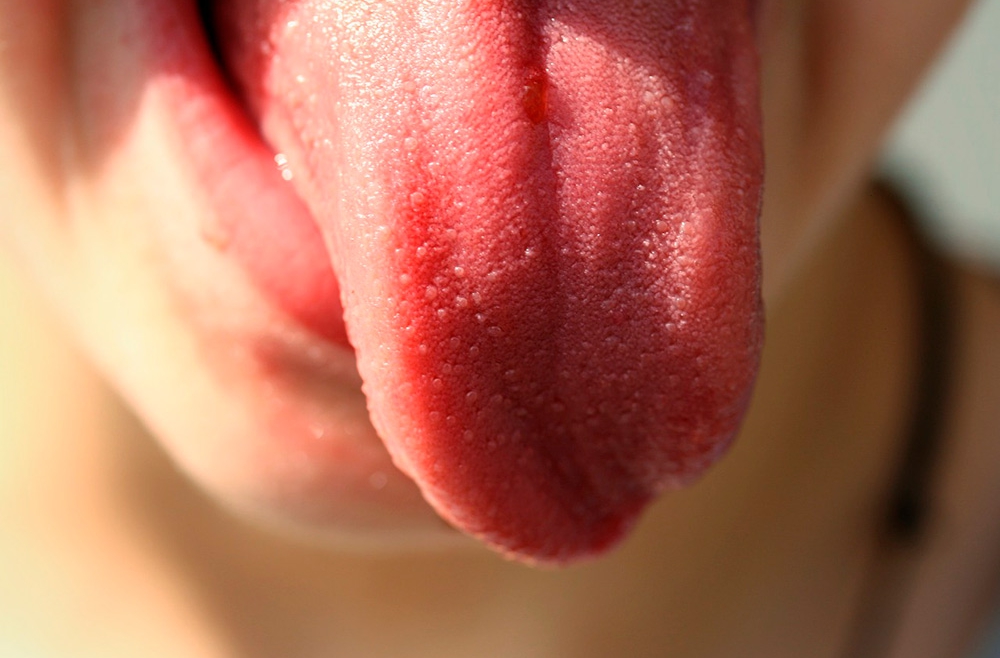 Las enfermedades en la lengua más comunes