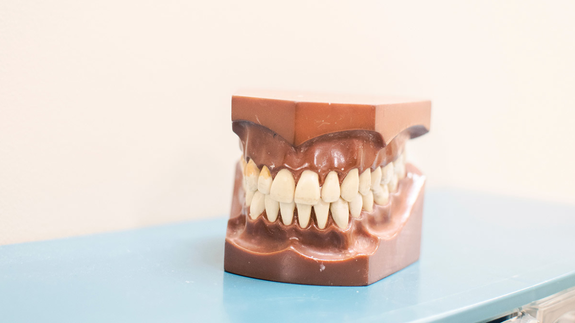 Causas y tipos de decoloración dental